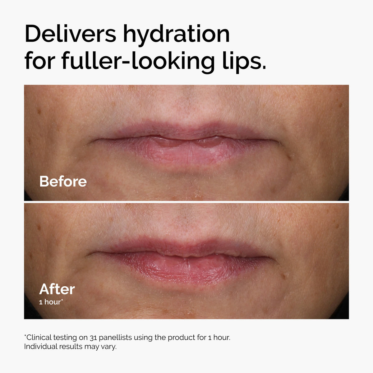 HA + Asiaticoside Lip Treatment