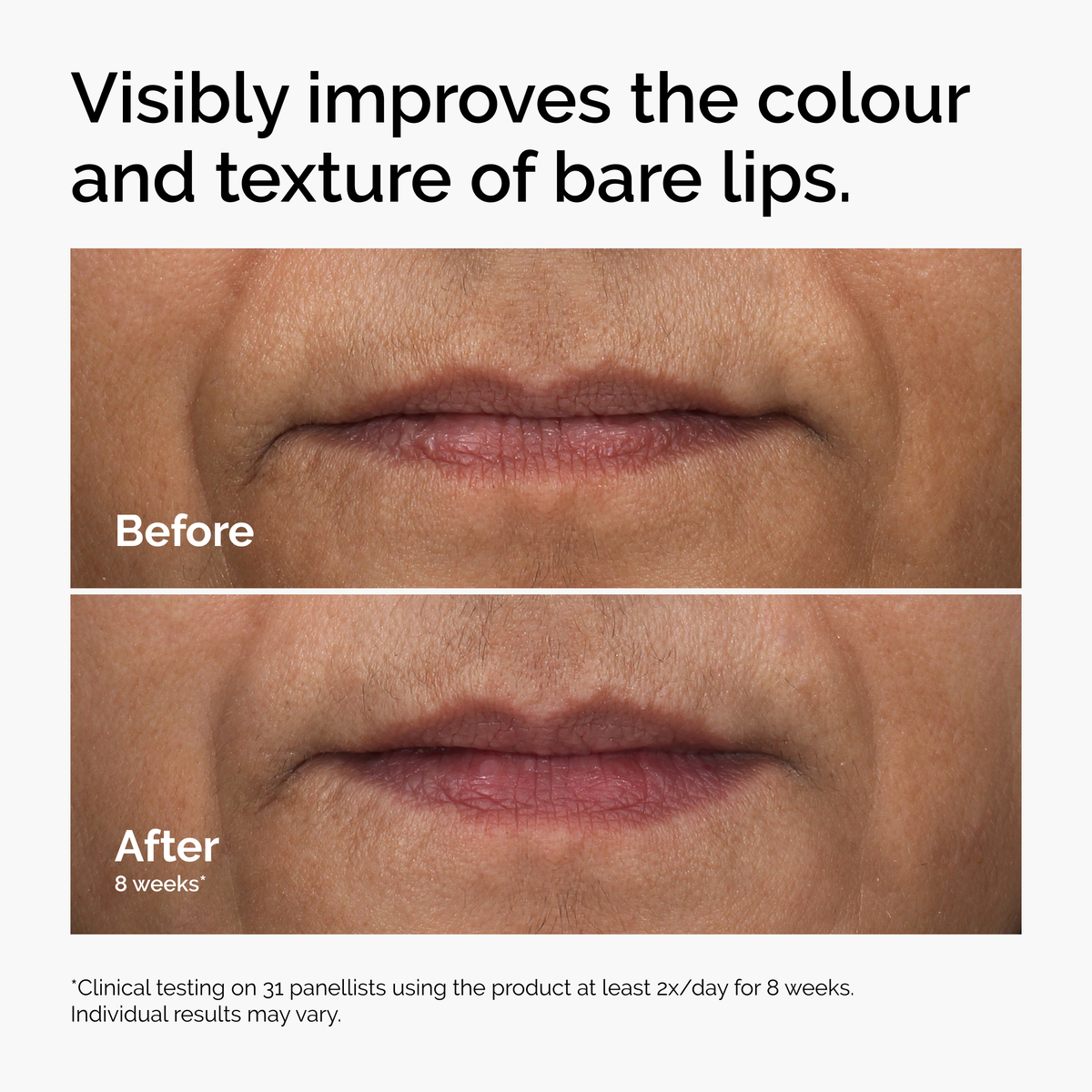 HA + Asiaticoside Lip Treatment