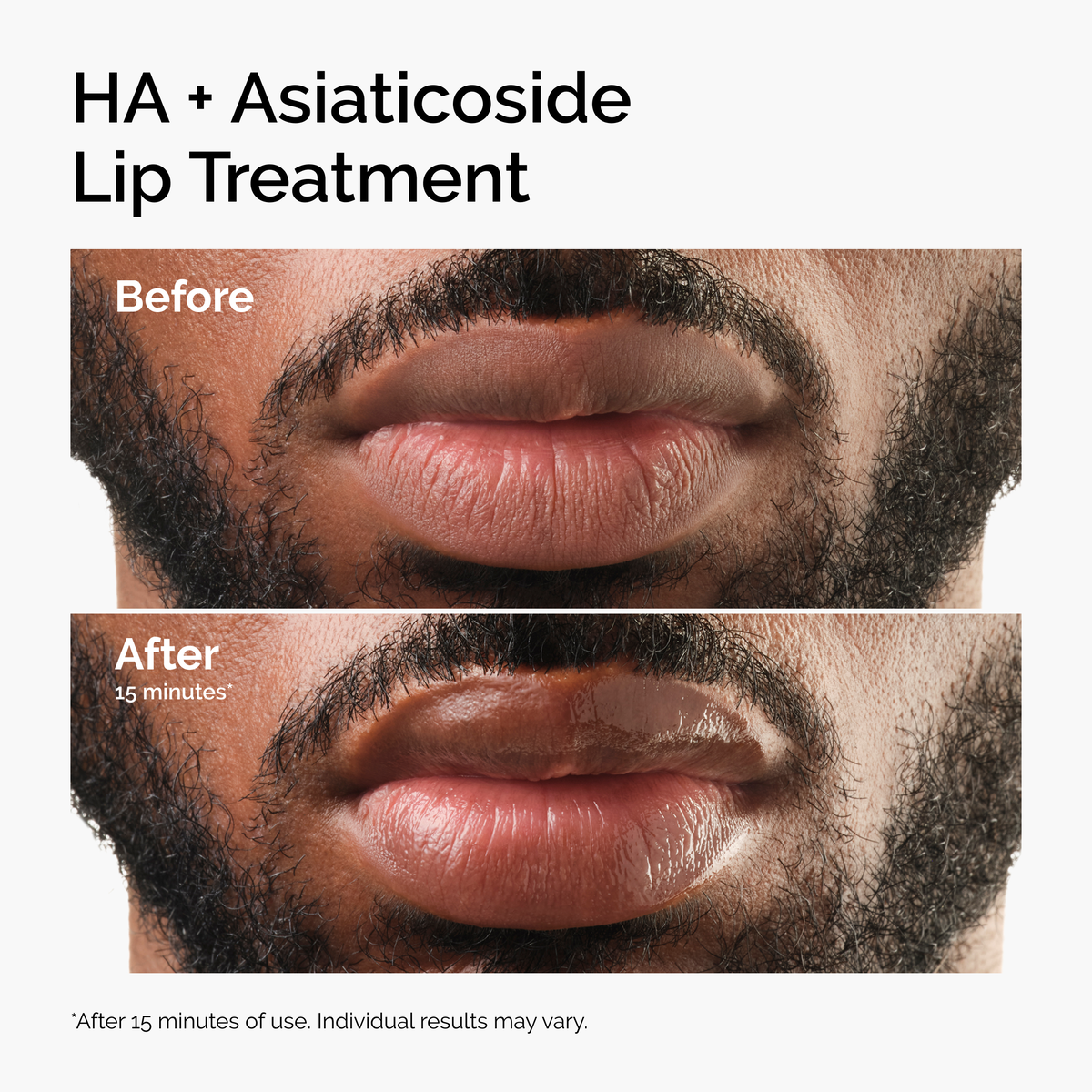 HA + Asiaticoside Lip Treatment